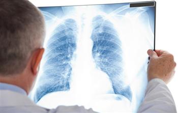 Chụp X-quang nhiều mai mốt ung thư chết luôn: Đâu là sự thật?